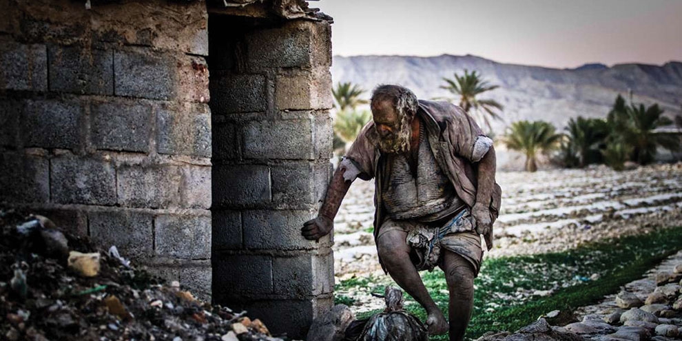 Dünyanın gelmiş geçmiş en “kirli” adamıyla tanışın: Amoo Hacı 6