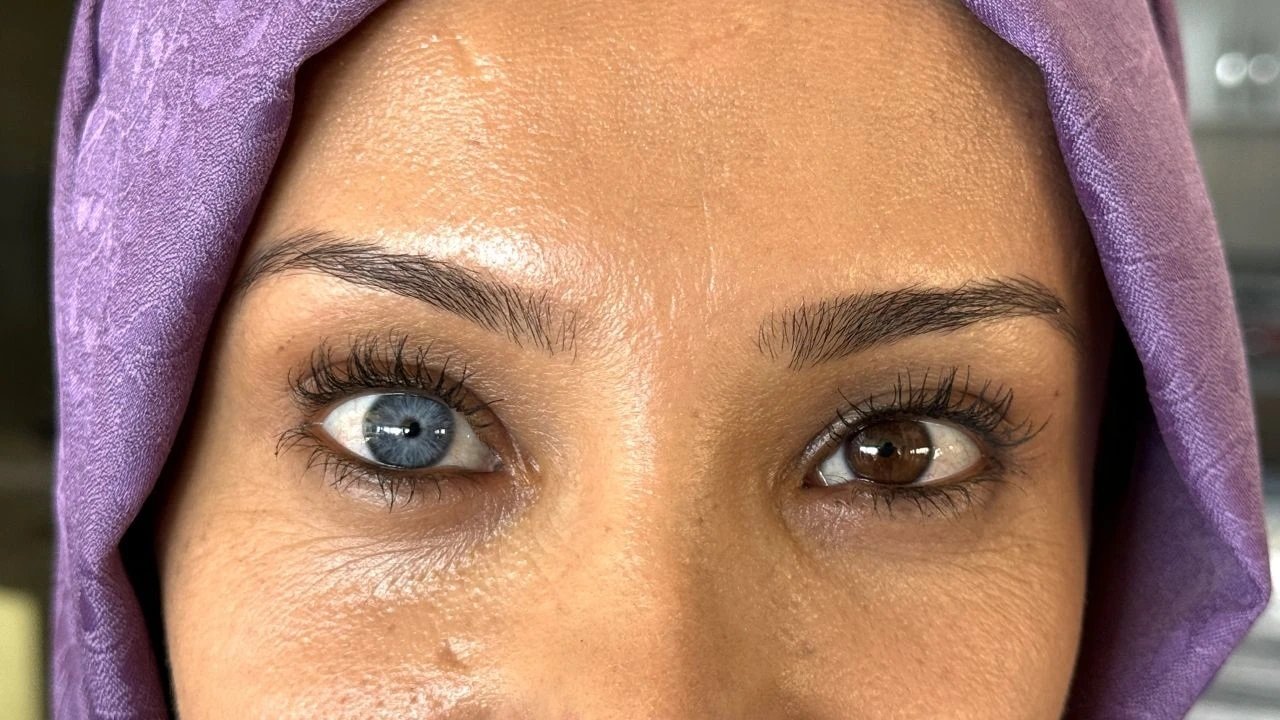 Mavi ve kahverengi gözlerinin doğallığına çevresindekileri inandırmaya çalışıyor