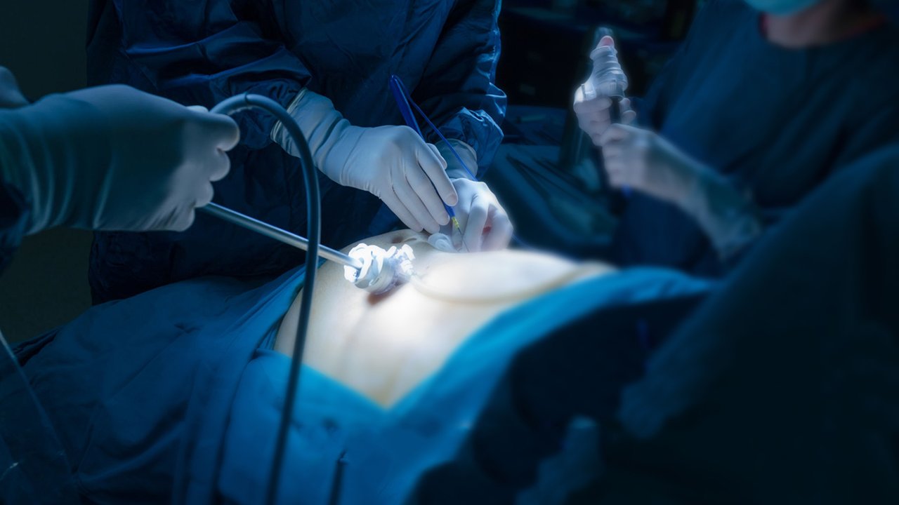 Rüyada Ameliyat görmek ne anlama gelir?