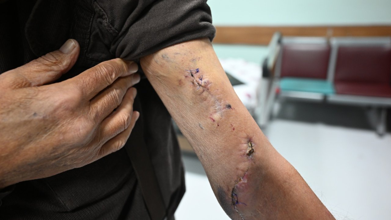 KSÜ Tıp, başarılı ameliyatlarıyla bölgeye yanıt veriyor