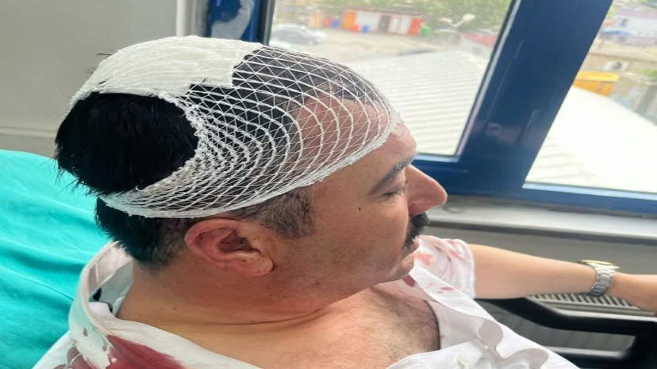 Kahramanmaraş’ta belediye başkan yardımcısına saldırı