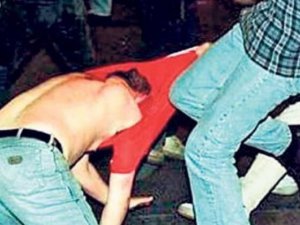 Fenerbahçeli taraftarın bacağı koptu