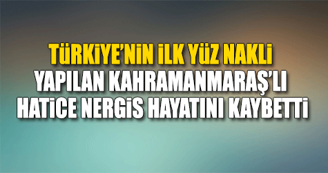 Türkiye'nin yüz nakli yapılan ilk kadını hayatını kaybetti