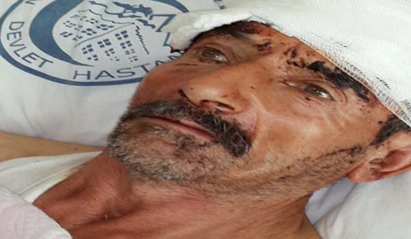 KAYIP KOYUNUNU ARARKEN KÖPEKLERİN SALDIRISINA UĞRADI