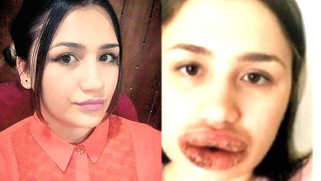 Estetik skandalında flaş gelişme!