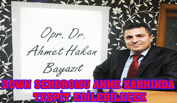 DOWN SENDROMU ANNE KARNINDA TESPİT EDİLEBİLECEK