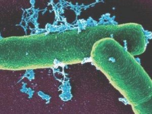 Valilik açıkladı: Sonuçlar pozitif!