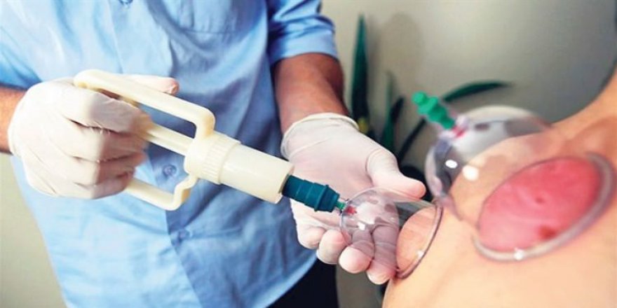 Kamuda sülük ve hacamat eğitimi