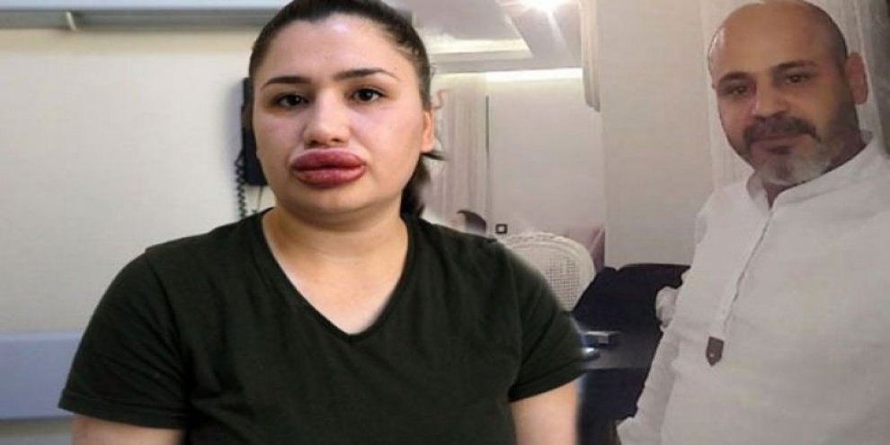 Sahte estetikçi inşaat silikonu enjekte etmiş