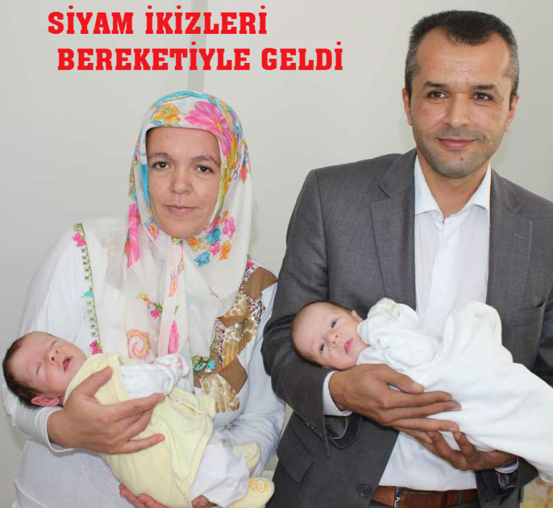 SİYAM İKİZLERİ BEREKETİYLE GELDİ