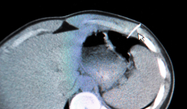 ENJEKTÖRLÜ ŞAKA HASTANEDE BİTTİ