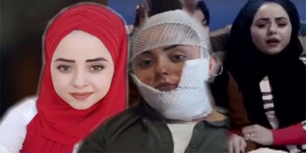 Dehşeti yaşadı! Havai fişek yüzünde patladı