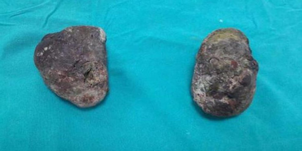 1,5 kilo Trabzon hurması yedi...