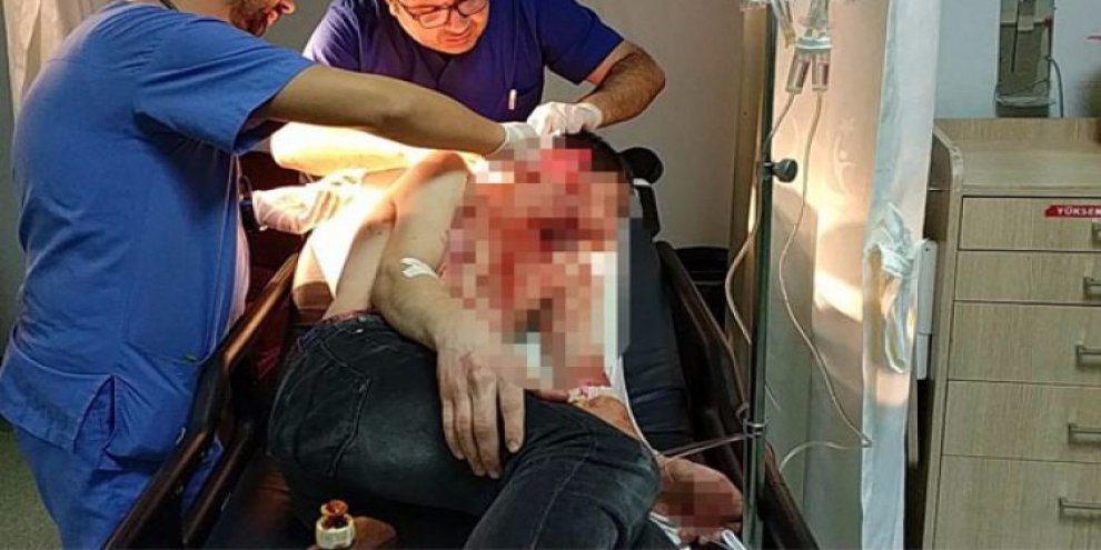 Dehşet! Travesti ustura ile onu bu hale getirdi..