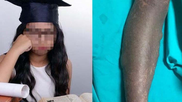 Doktorun verdiği ilaçları kullandı! Sonucu dehşet