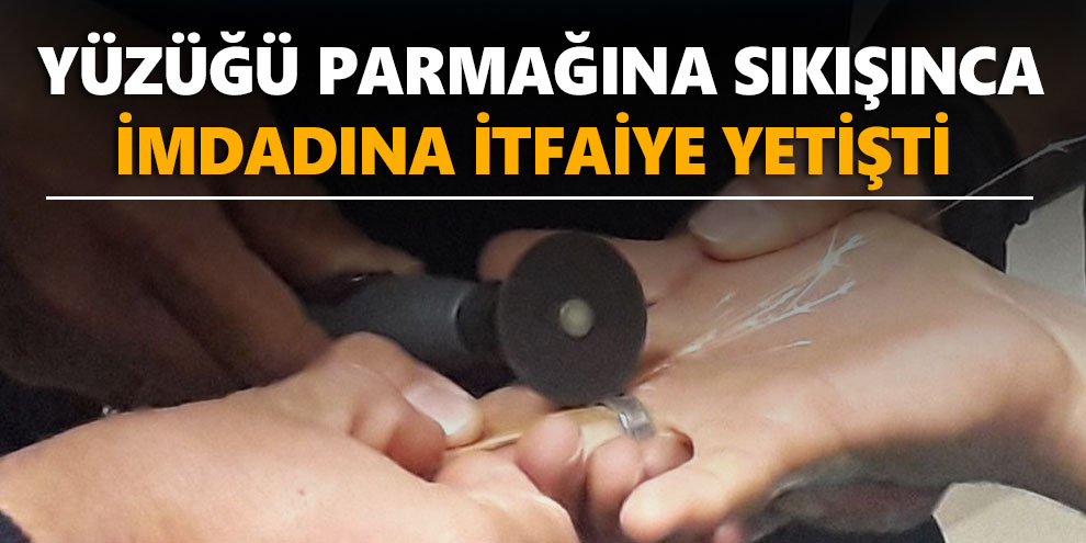Yüzüğü parmağına sıkışınca imdadına itfaiye yetişti
