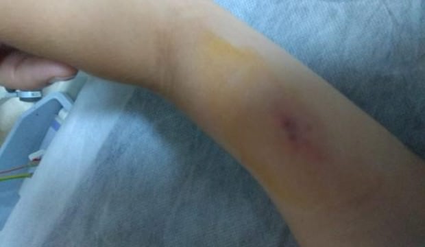 4 yaşındaki çocuğu yılan ısırdı