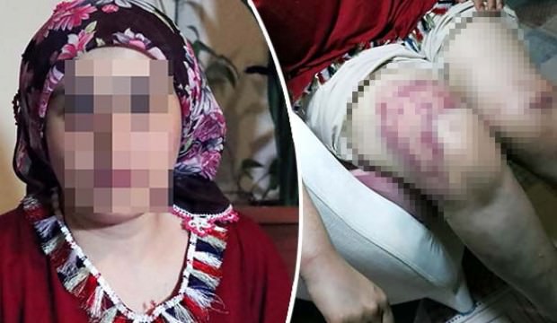 Kayınpeder saatlerce işkence etti! 12 yıllık kabus