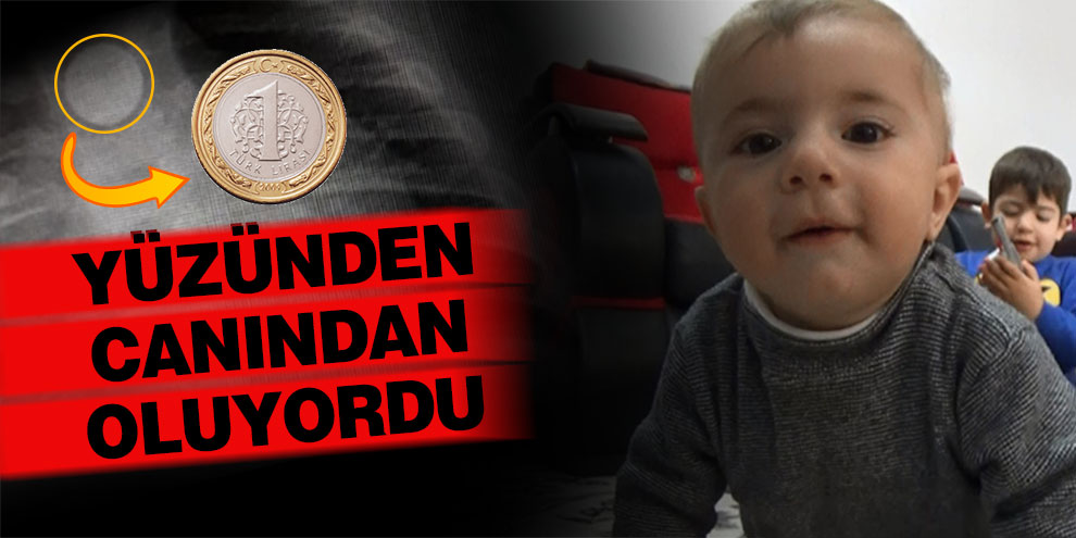 1 lira yüzünden canından oluyordu