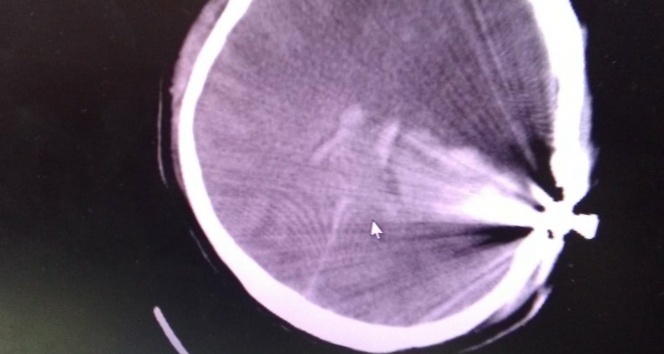 Esrarengiz olayı kafadaki bu mermi çözecek