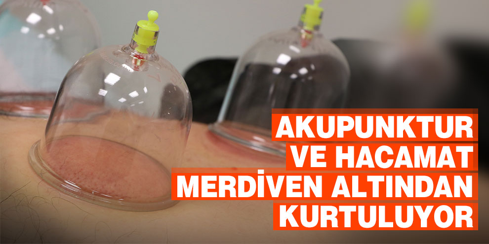Akupunktur ve hacamat merdiven altından kurtuluyor