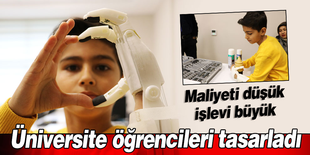 Eli olmayan çocuğa robotel yaptılar