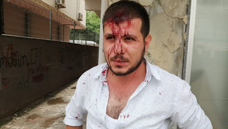 Kaldırım taşlı dehşet!