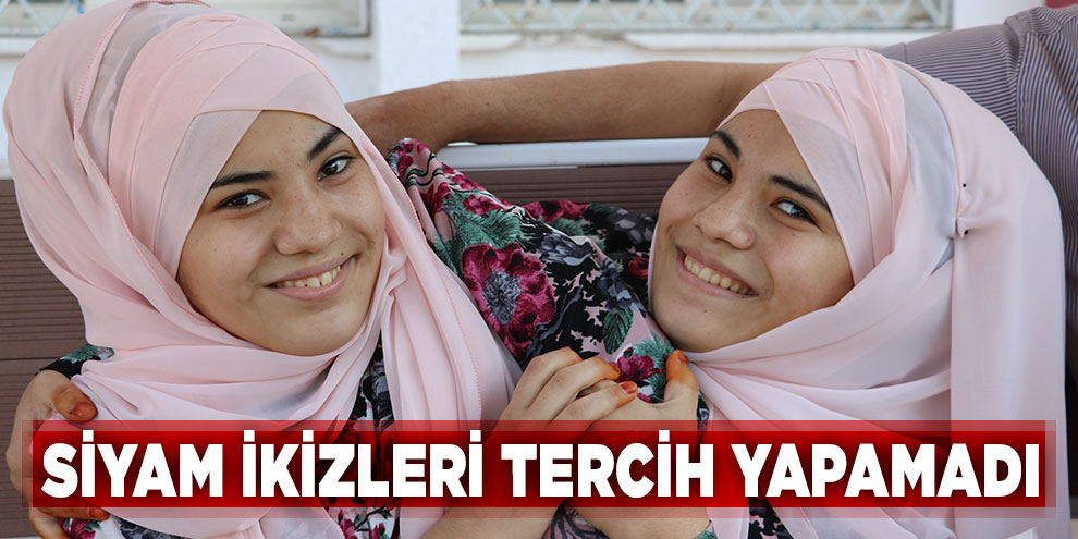 Siyam ikizleri tercih yapamadı