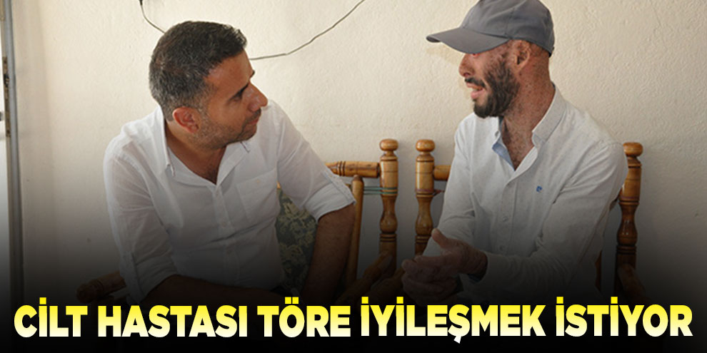 Cilt hastası Töre iyileşmek istiyor