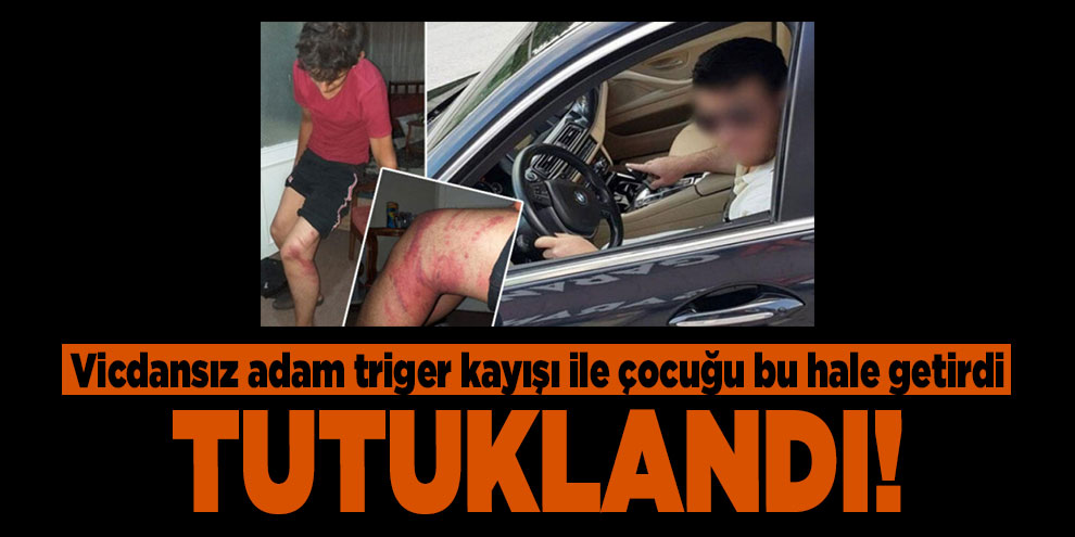 Çırağını bu hale getiren şahıs tutuklandı!