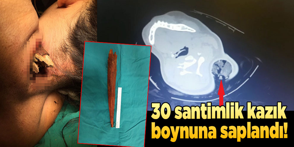 Boynuna 30 santimlik kazık saplandı!