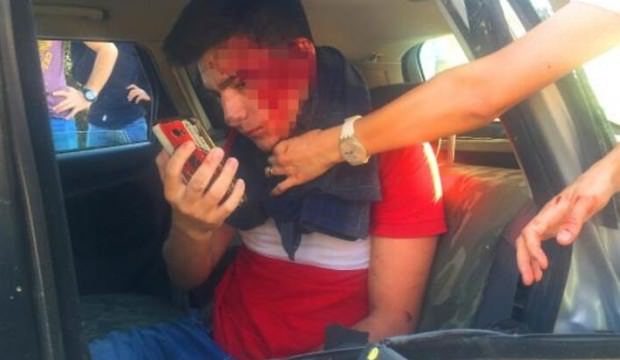 Kazada araçta sıkıştı, yüzünü kontrol etmek için selfie çekti