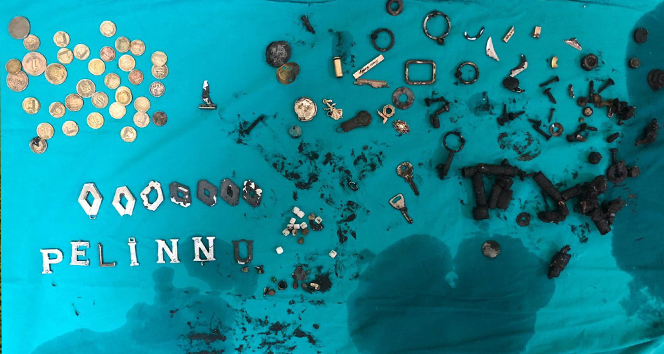 Doktorlar bile şaşırdı: 680 gram metal yuttu