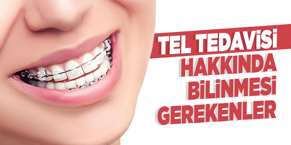 Tel tedavisi hakkında bilinmesi gerekenler