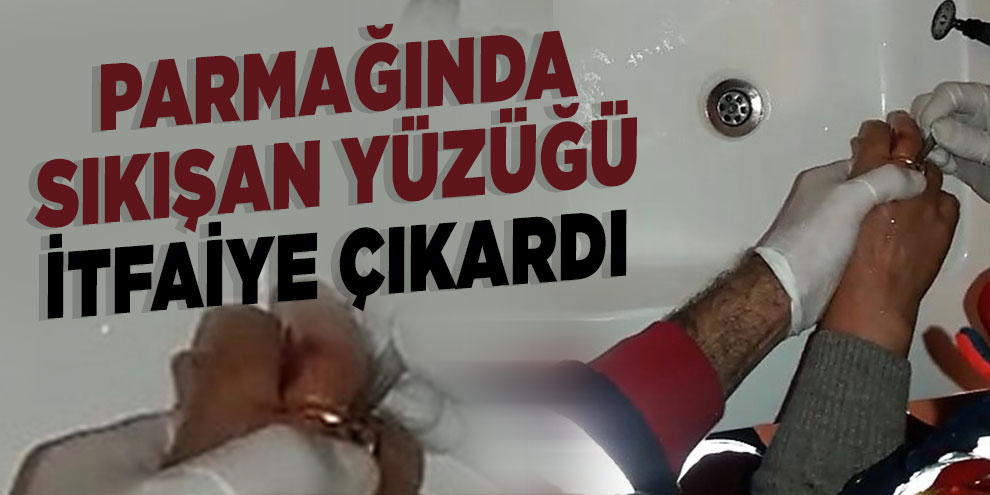 Parmağında sıkışan yüzüğü itfaiye çıkardı