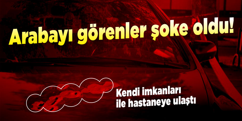 Arabayı görenler şoke oldu! Kendi imkanları ile hastaneye ulaştı