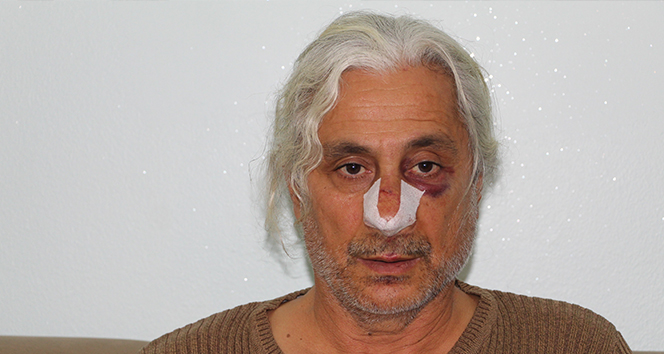 Batman'da teknik direktör ve sporculara demir çubuklarla saldırı