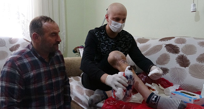 210 bin lira bulamazsa bacağı kesilecek