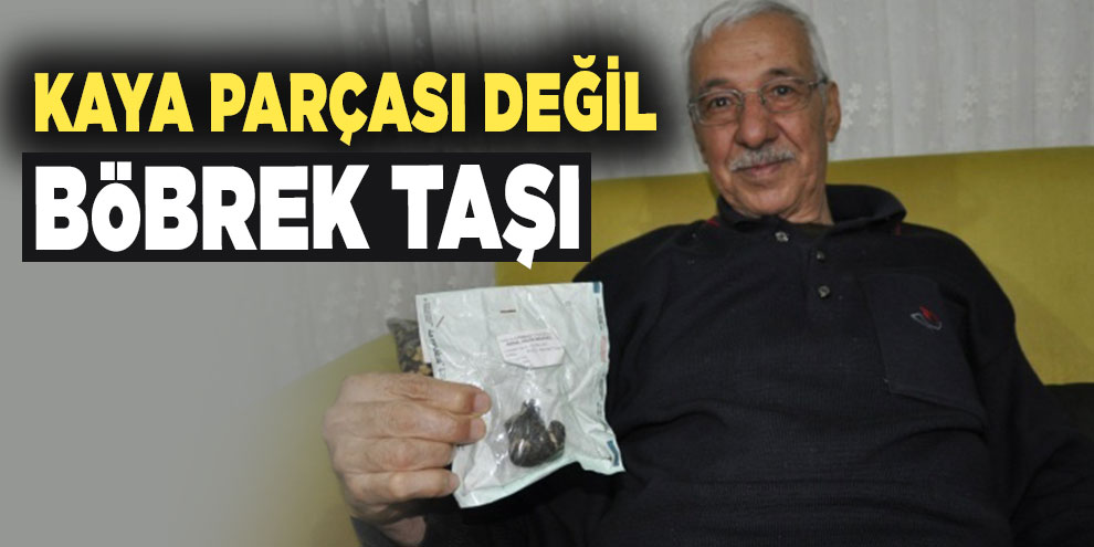 Kaya parçası değil böbrek taşı