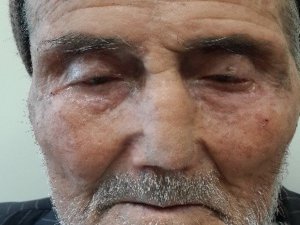 KSÜ TIP ALINDAN BURUN YAPTI