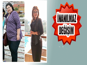 Hastalarıyla beraber kilo verdi!