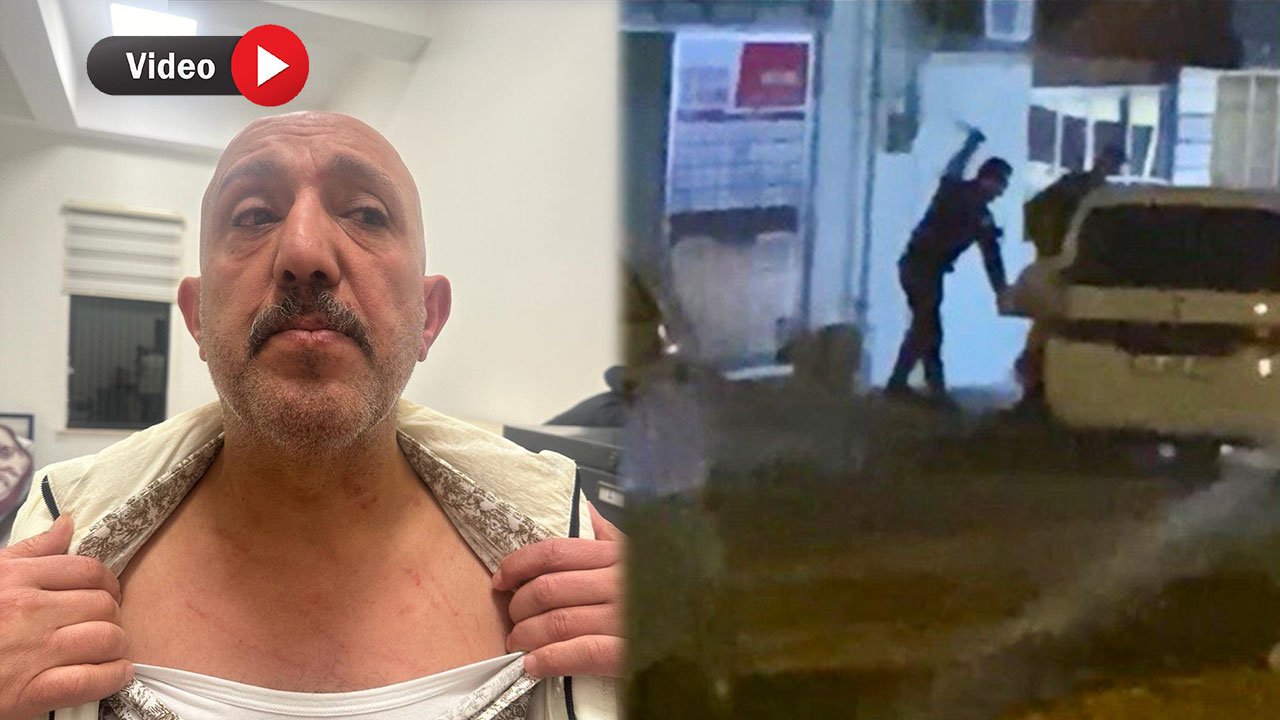 Kahramanmaraş’ta Gözaltına Alınan Şüpheli Bekçiler Tarafından Darp Edildi