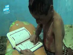 Suriye'de yaralanan çocuk acısını Kur'an ile dindirmeye çalışıyor